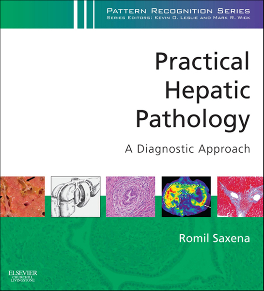 Practical Hepatic Pathology: A Diagnostic Approach E-Book