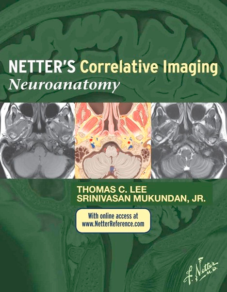 Netter's Correlative Imaging: Neuroanatomy