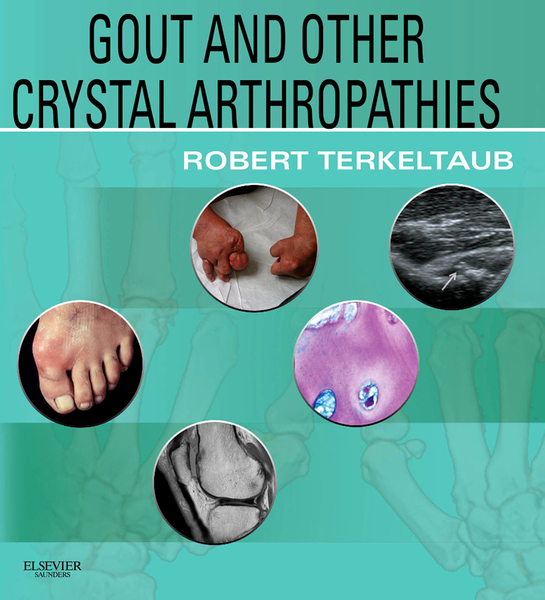 Gout & Other Crystal Arthropathies E-Book