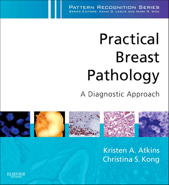 Practical Breast Pathology: A Diagnostic Approach E-Book