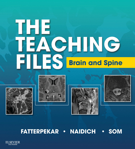 The Teaching Files: Brain and Spine Imaging E-Book