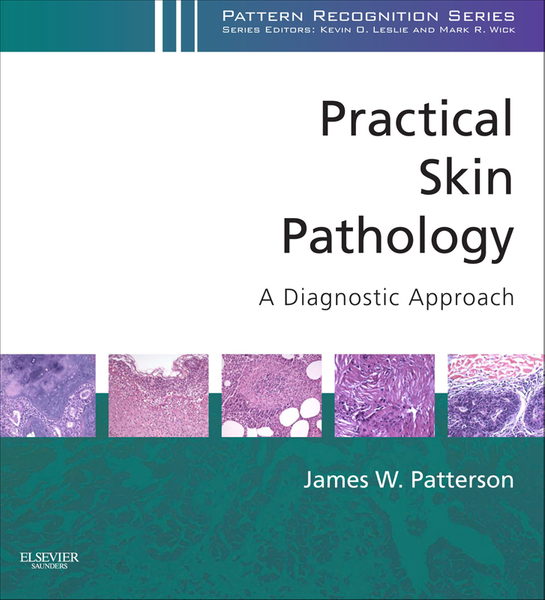 Practical Skin Pathology: A Diagnostic Approach E-Book