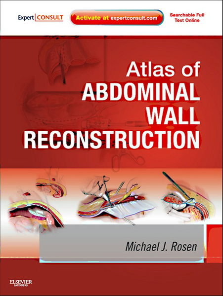 Atlas of Abdominal Wall Reconstruction E-Book