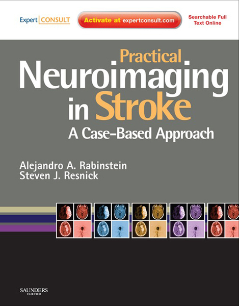 Practical Neuroimaging in Stroke E-Book