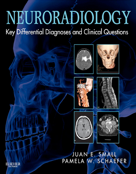 Neuroradiology: Key Differential Diagnoses and Clinical Questions E-Book