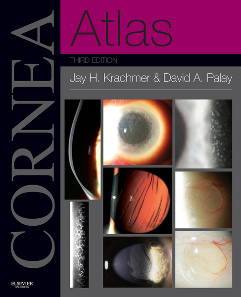 Cornea Atlas