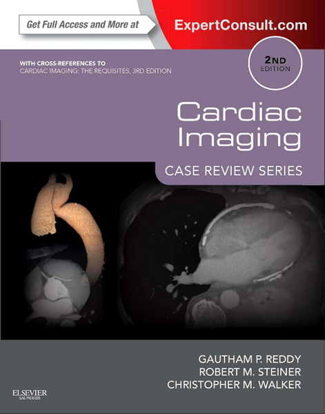 Cardiac Imaging: Case Review Series E-Book