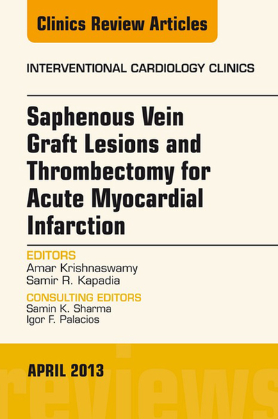 Saphenous Vein Graft Lesions and Thrombectomy for Acute Myocardial Infarction, An Issue of Interventional Cardiology Clinics, E-Book