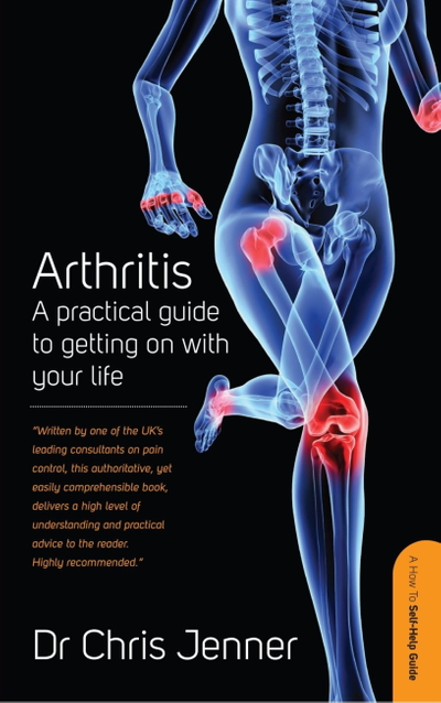 Arthritis