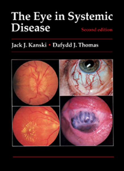 The Eye in Systemic Disease