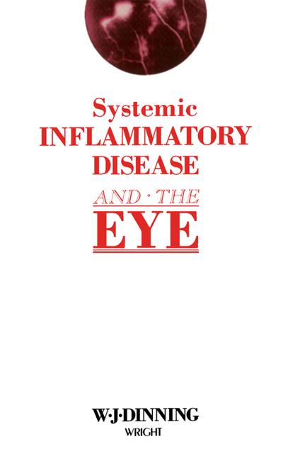 Systemic Inflammatory Disease and the Eye