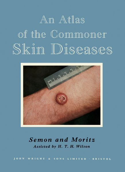 An Atlas of the Commoner Skin Diseases