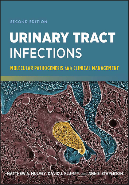 Urinary Tract Infections