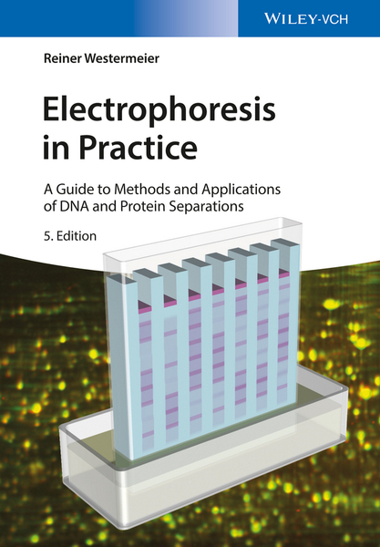 Electrophoresis in Practice