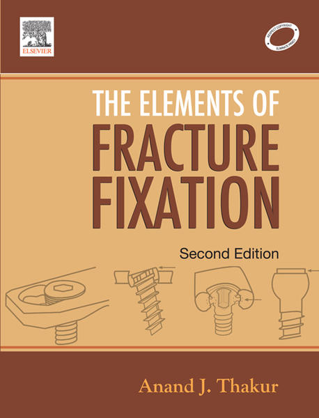 Elements of Fracture Fixation - E-Book